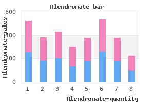 alendronate 35mg low price