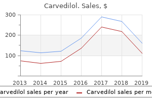 buy carvedilol 6.25mg without a prescription