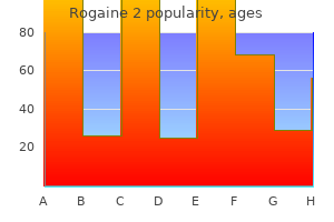 60 ml rogaine 2