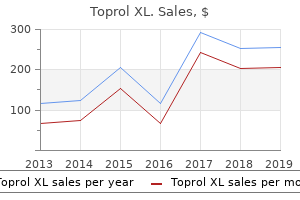 discount toprol xl 50mg line