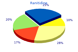 order 150 mg ranitidine fast delivery