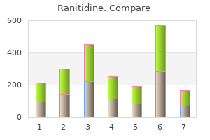 buy ranitidine 300mg