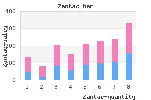 generic zantac 150mg with mastercard