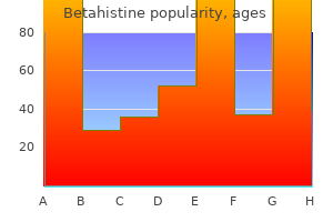 purchase 16 mg betahistine mastercard