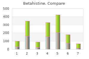 cheap betahistine 16mg with mastercard