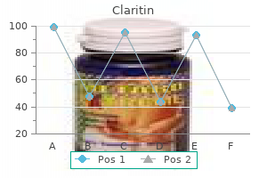 claritin 10 mg with amex
