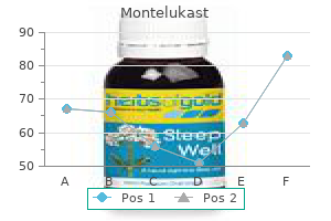 generic 4 mg montelukast amex