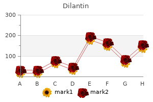 order dilantin 100 mg with amex