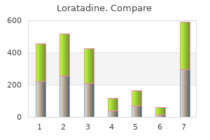 discount 10 mg loratadine amex