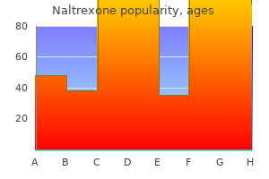 discount naltrexone 50 mg otc