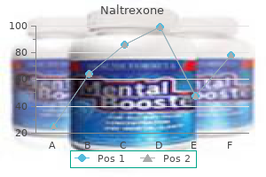 buy discount naltrexone 50mg on-line