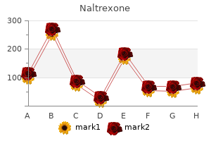 cheap 50mg naltrexone with mastercard