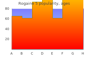 discount rogaine 5 60ml overnight delivery