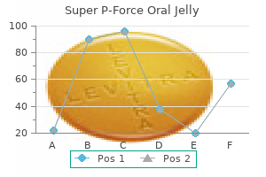 cheap 160mg super p-force oral jelly mastercard